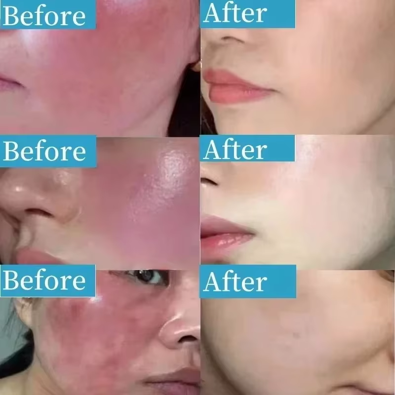 Crème réparatrice des rougeurs - Coenzyme Q10 Cream avis et prix