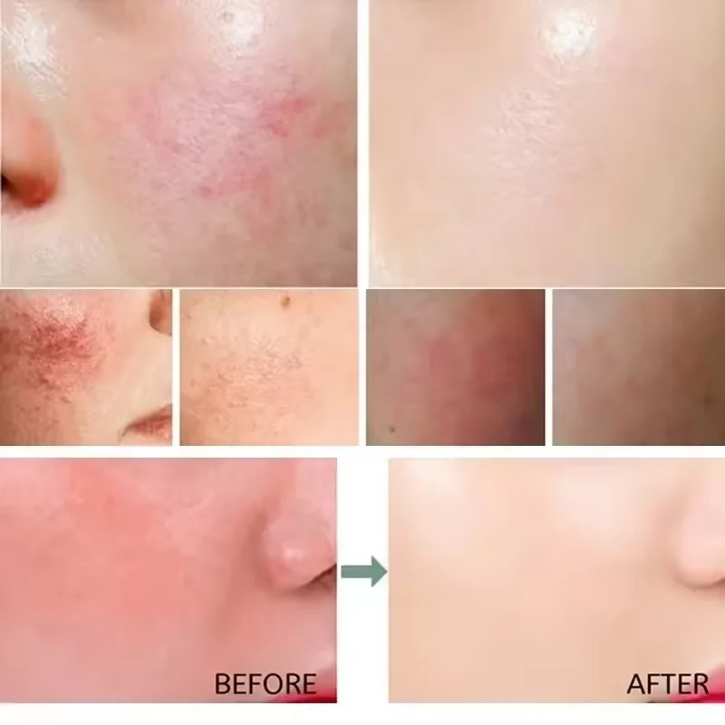 Crème réparatrice pour les rou - Coenzyme Q10 Cream avis et prix